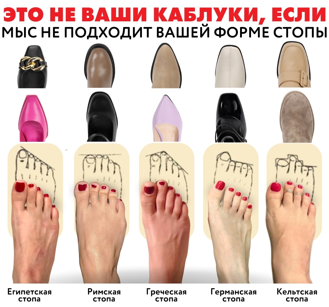 Типы стоп